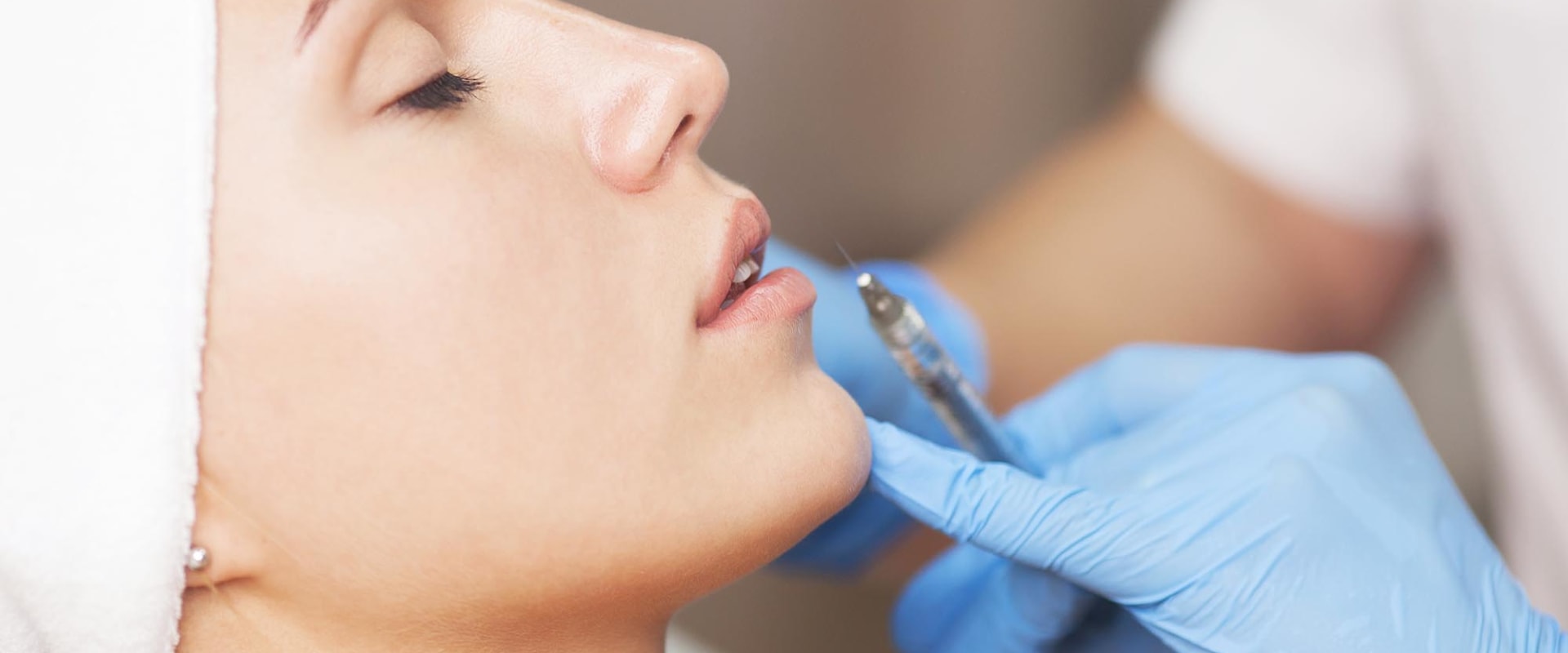 What Happens When Fillers Migrate?